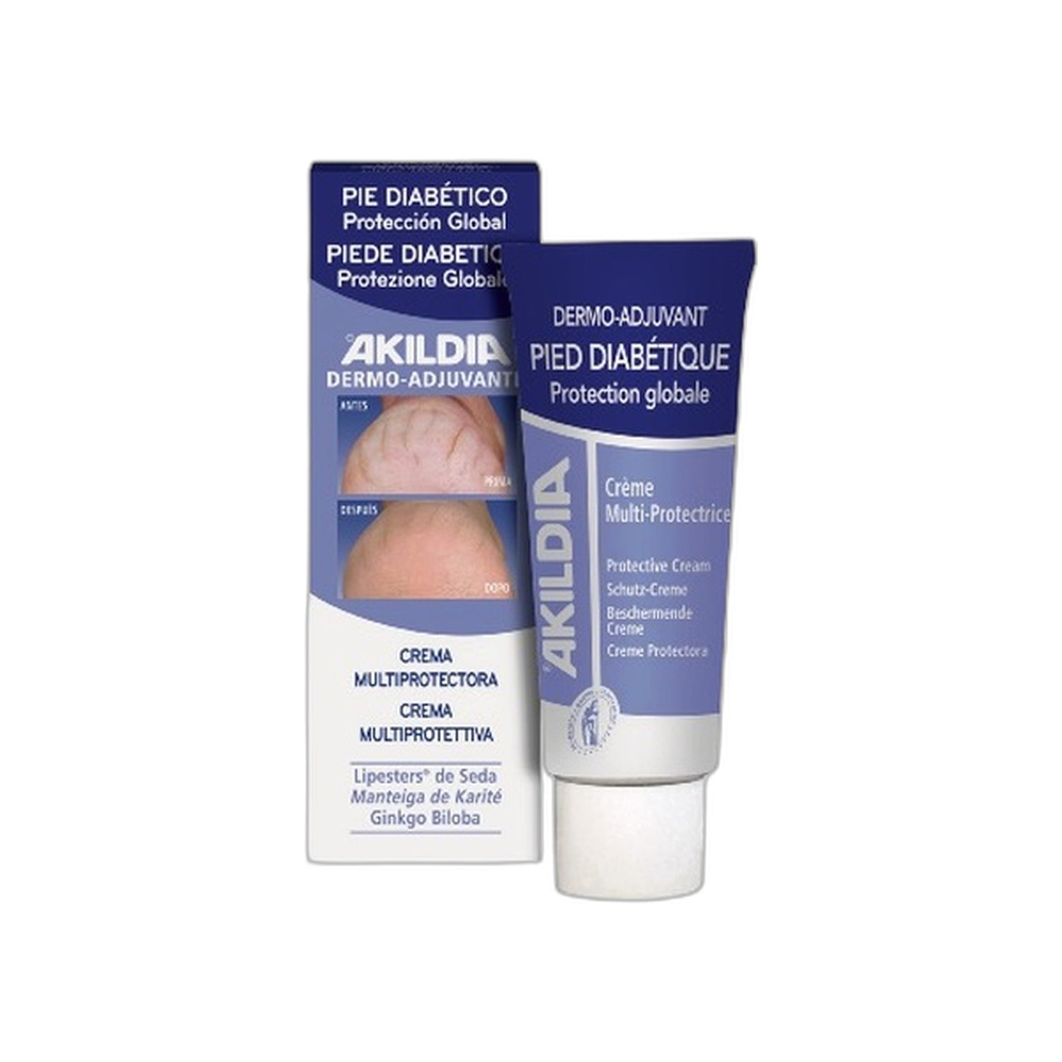 Akildia Creme Para Pés Diabéticos 150 ml